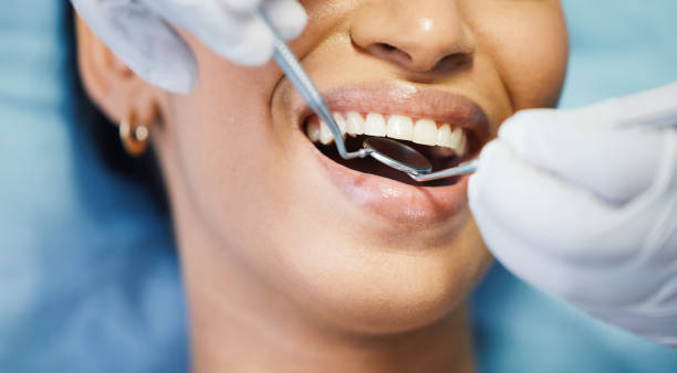 Best Emergency Wisdom Teeth Removal in Hartford City, IN